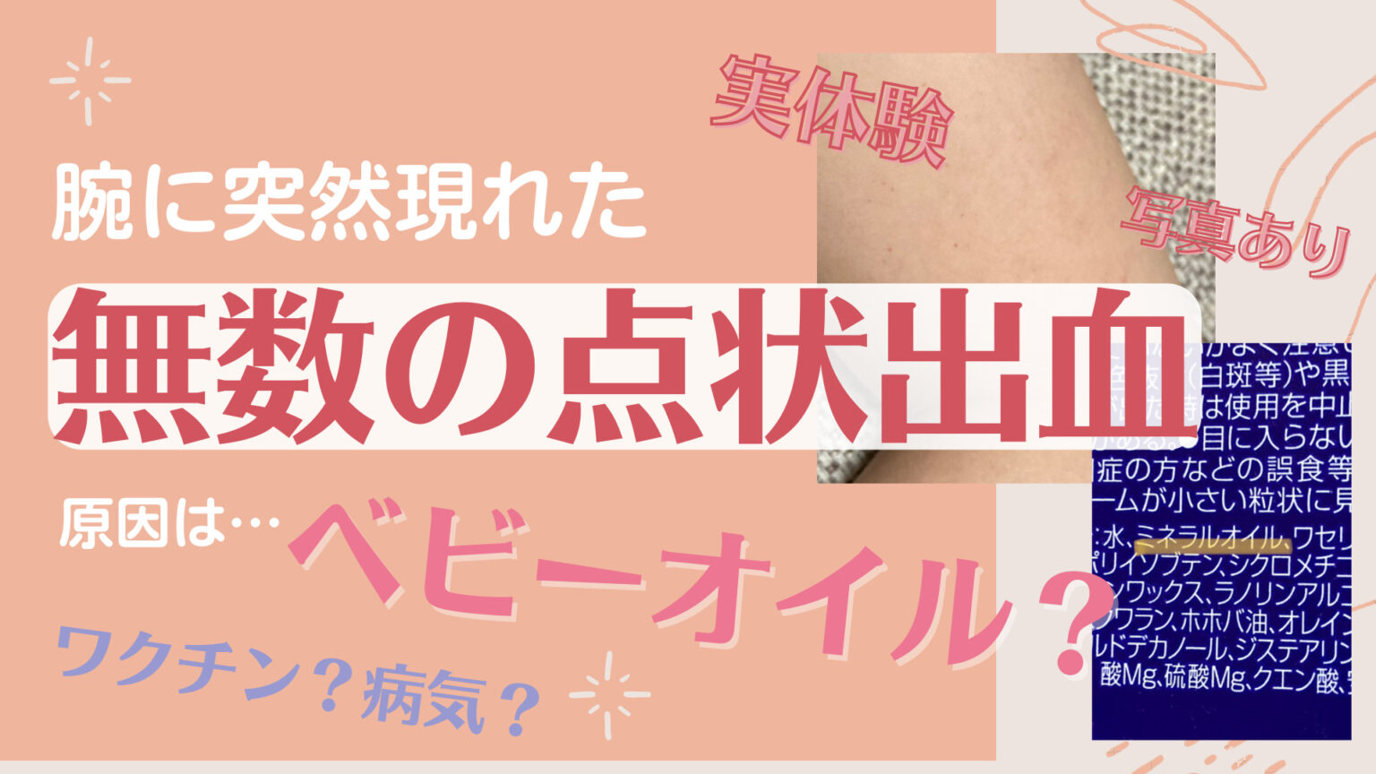 点状出血の写真